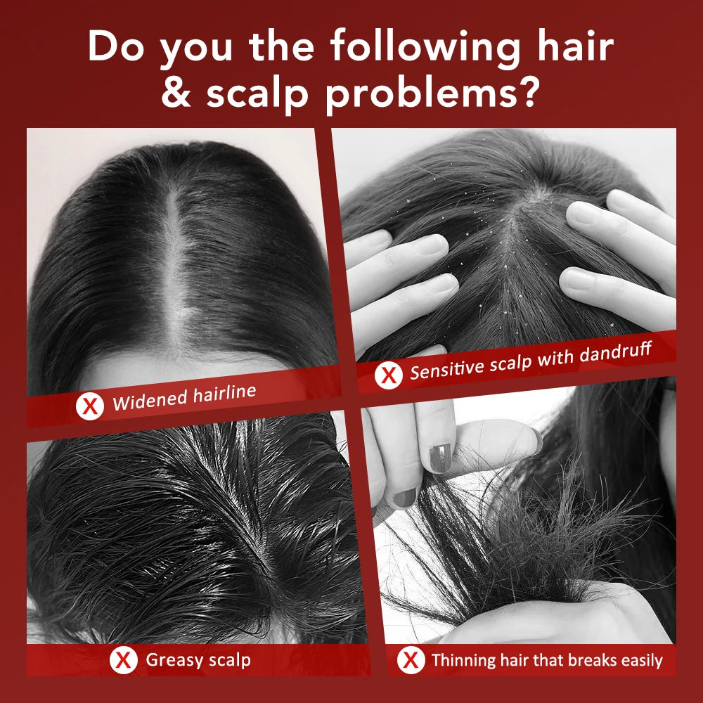 Electric Scalp Massage Comb Infrared Light Head Massager for Hair Growth Medicine Scalp Oil Applicator Anti-Hair Loss Hair Care